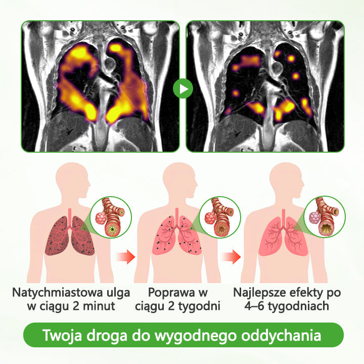🌿CleraNaure® HerbaAir Mullein Oczyszczacz Płuc